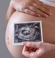 Mujer Embarazada Foto Su Futuro Bebe 1