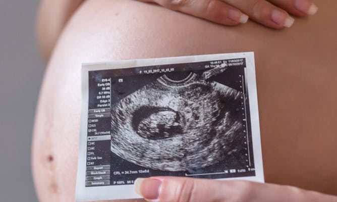 Mujer Embarazada Foto Su Futuro Bebe 1